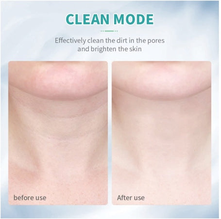 Neck Anti Wrinkle Face Lifting Beauty Device